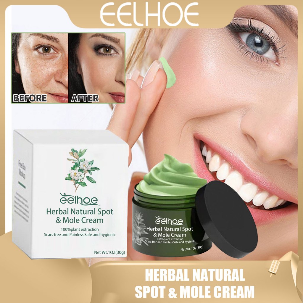 eelhoe-herbal-natural-spot-cream-vitiligo-cream-white-spots-removal