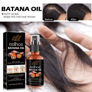 Batana Oil for Hair Growth - Batana Oil Organic for Healthy Hair, Batana  Oil for Hair Healthier Thicker Fuller, 100% Natural Hair Growth Serum for  Men