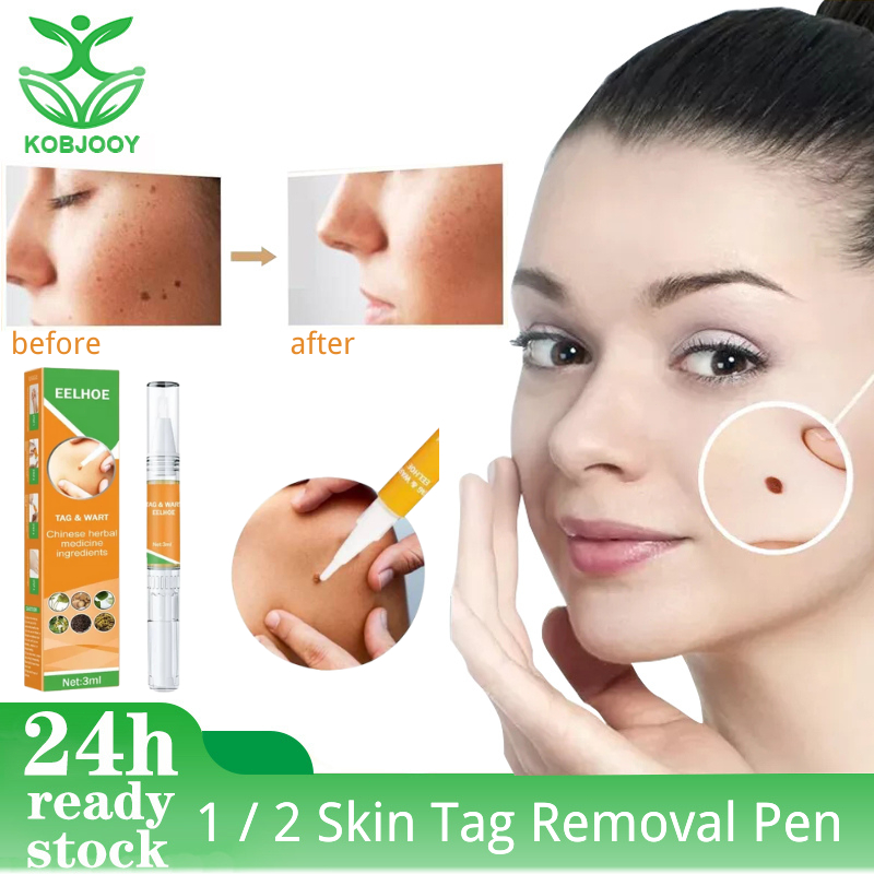 1 / 2 skin label removal pen, fight against mole and genital warts ...