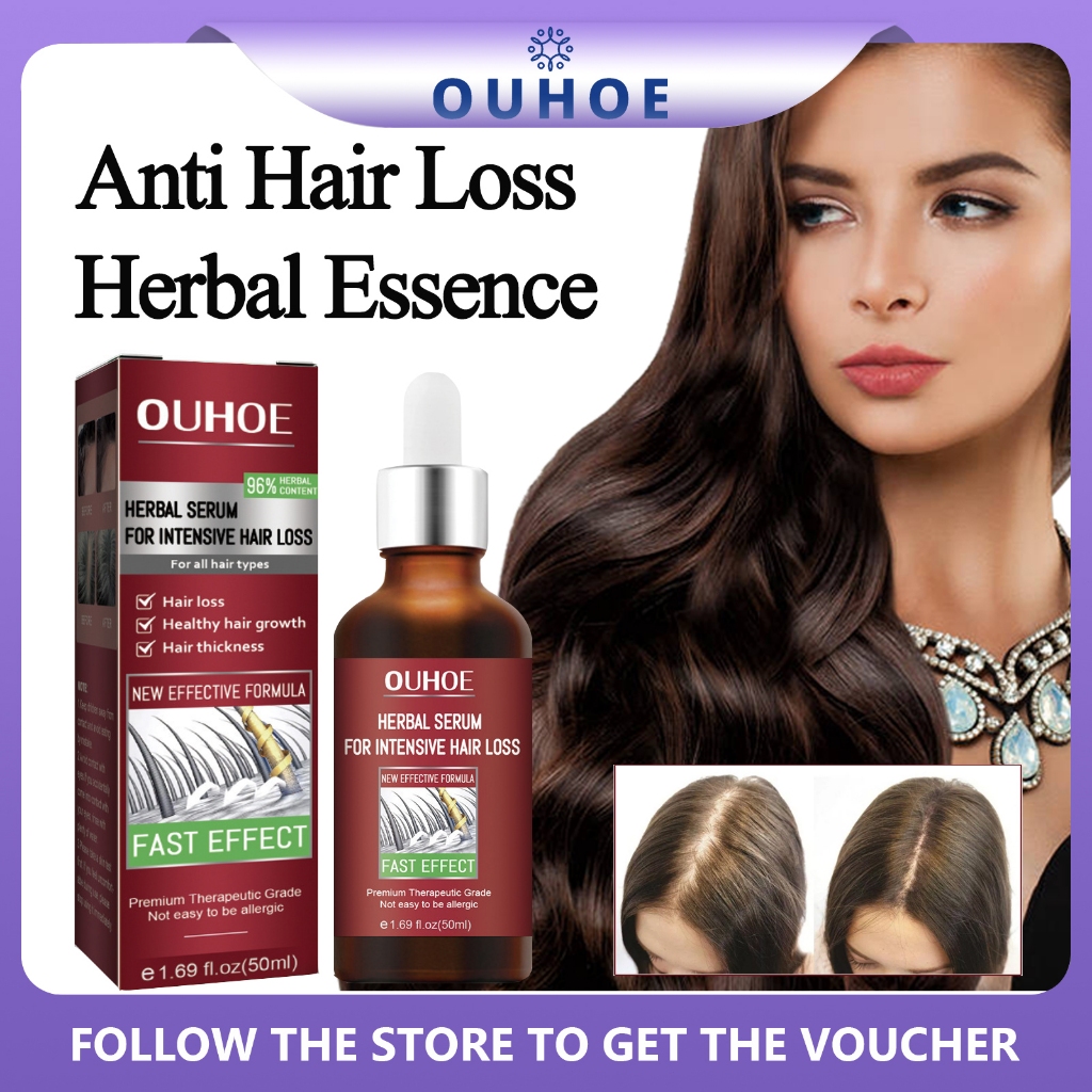 OUHOE Anti Hair Loss Herbal Essence 50ml Hair Growth Serum Scalp