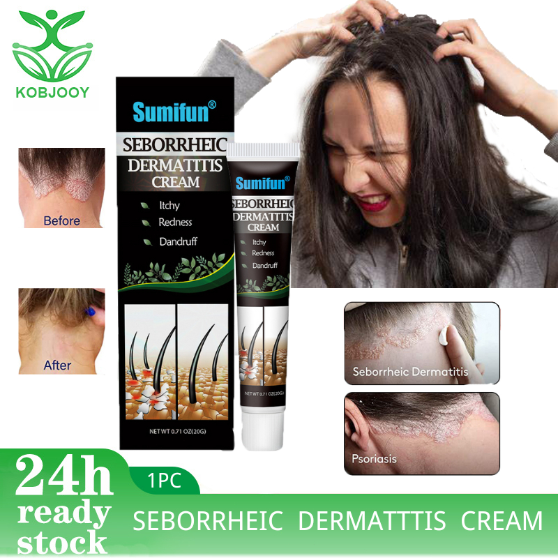 Sumifun seborrheic dermatitis care for head itching and tinea scalp ...