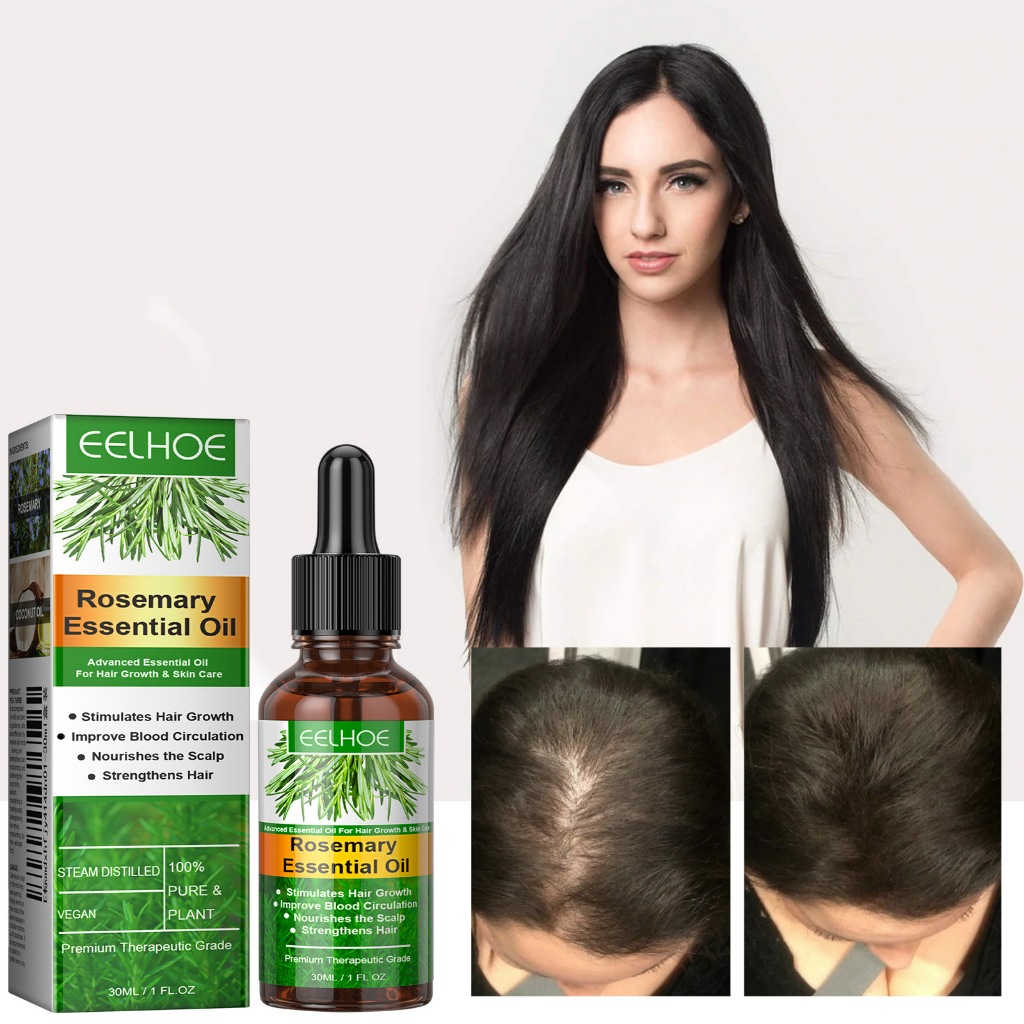 Eelhoe Rosemary Essential Oil Essential Oil Anti Hair Loss Fast ...