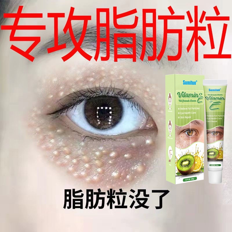 Milia seed remover Vitamin E Fat particle removal ointment, repair of