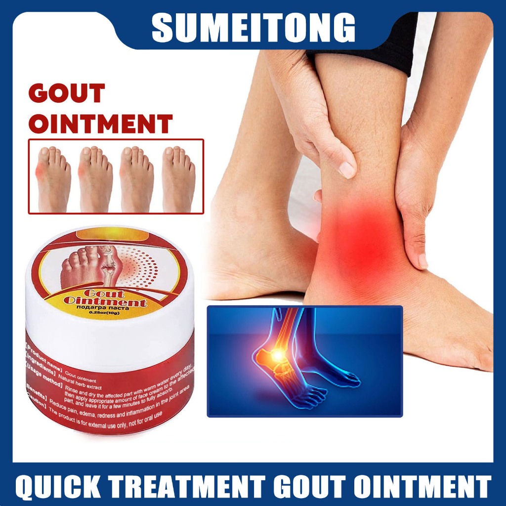 OUHOE Gout Ointment Sumifun Gout Treatment Ointment Joint Hallux Valgus ...