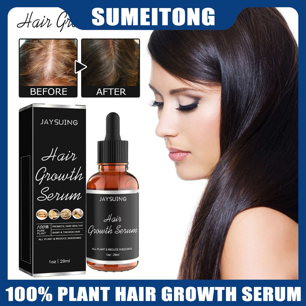 Jaysuing Hair Growth Serum Ginger Anti-Hair Loss Essense Smooth hair ...