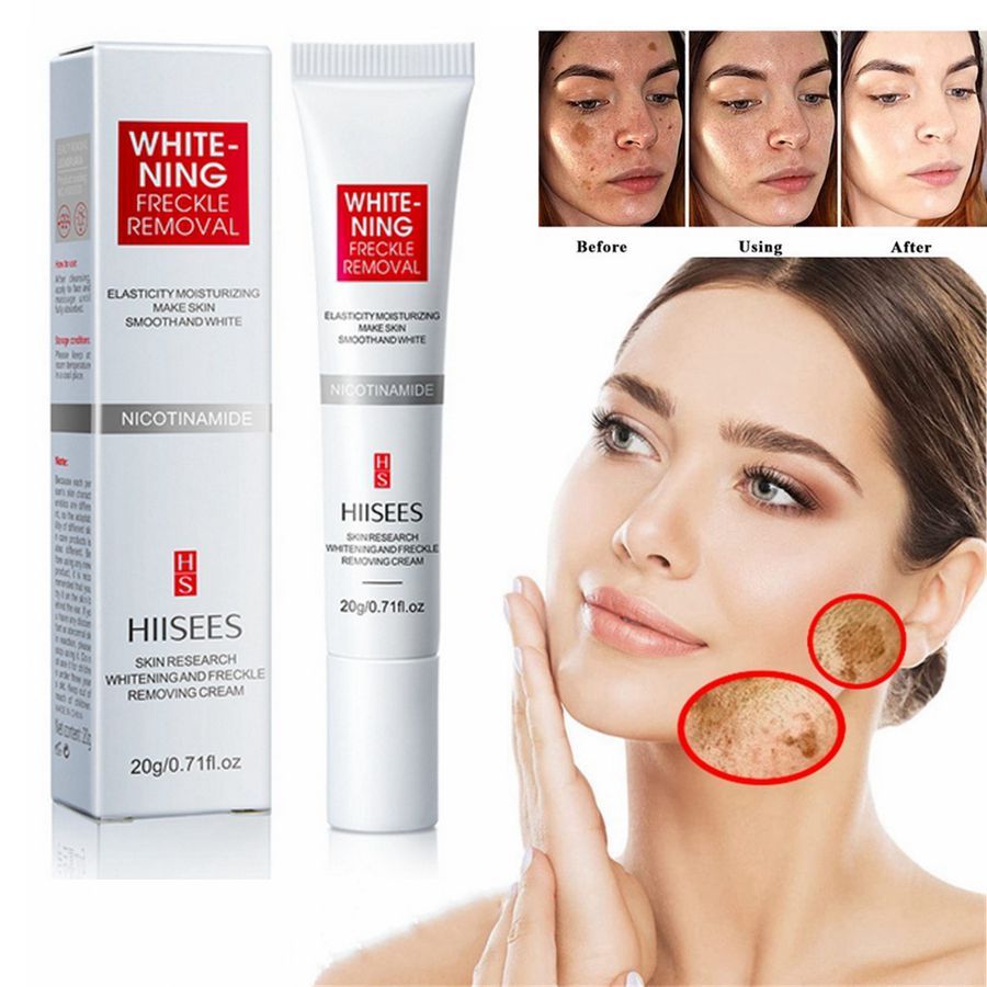 HIISEES Freckle Whitening Cream Remove Dark Spots Anti Freckle Cream ...