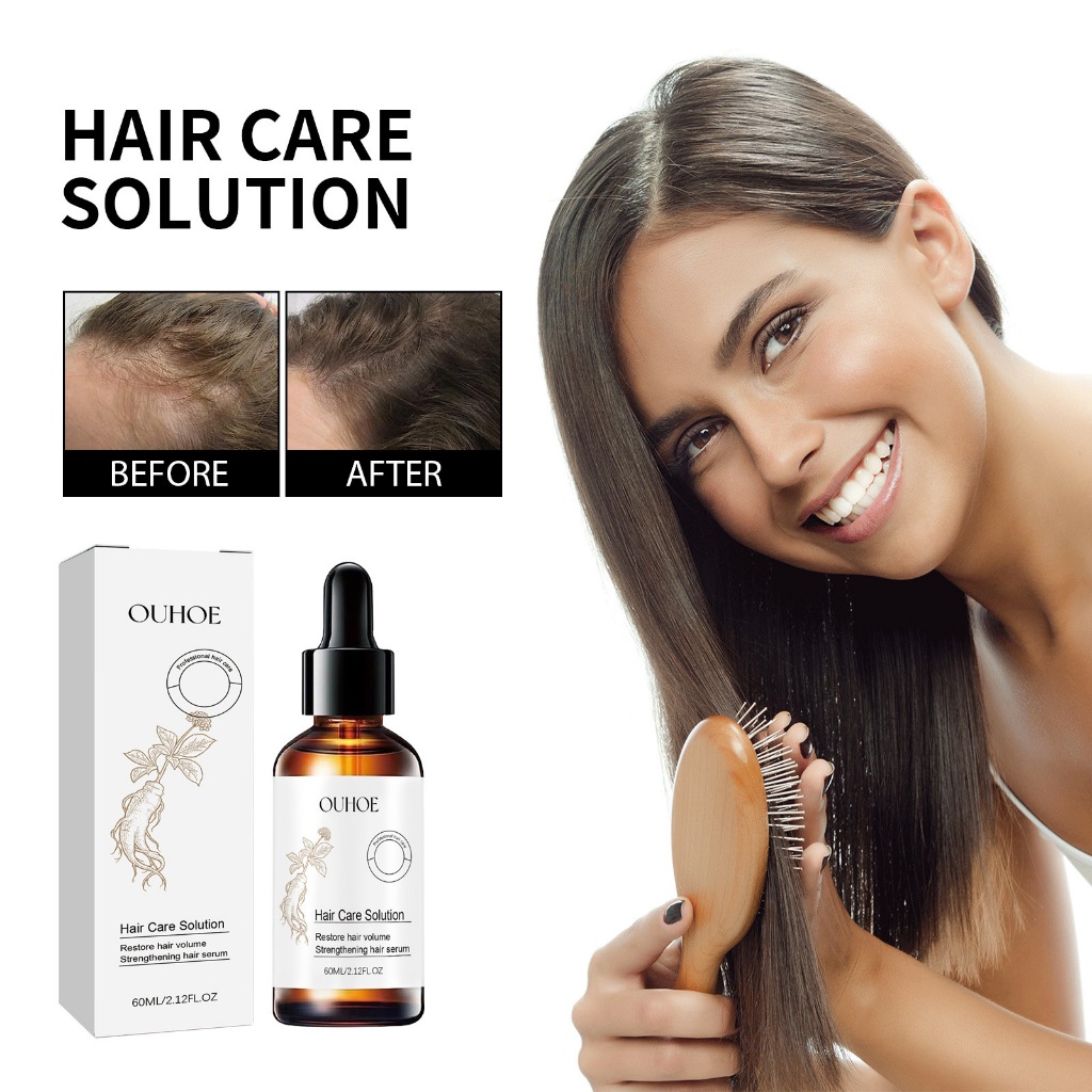 60ml Ouhoe Hair Dense Lotion Moisturizes And Prevents Hair Roots From 