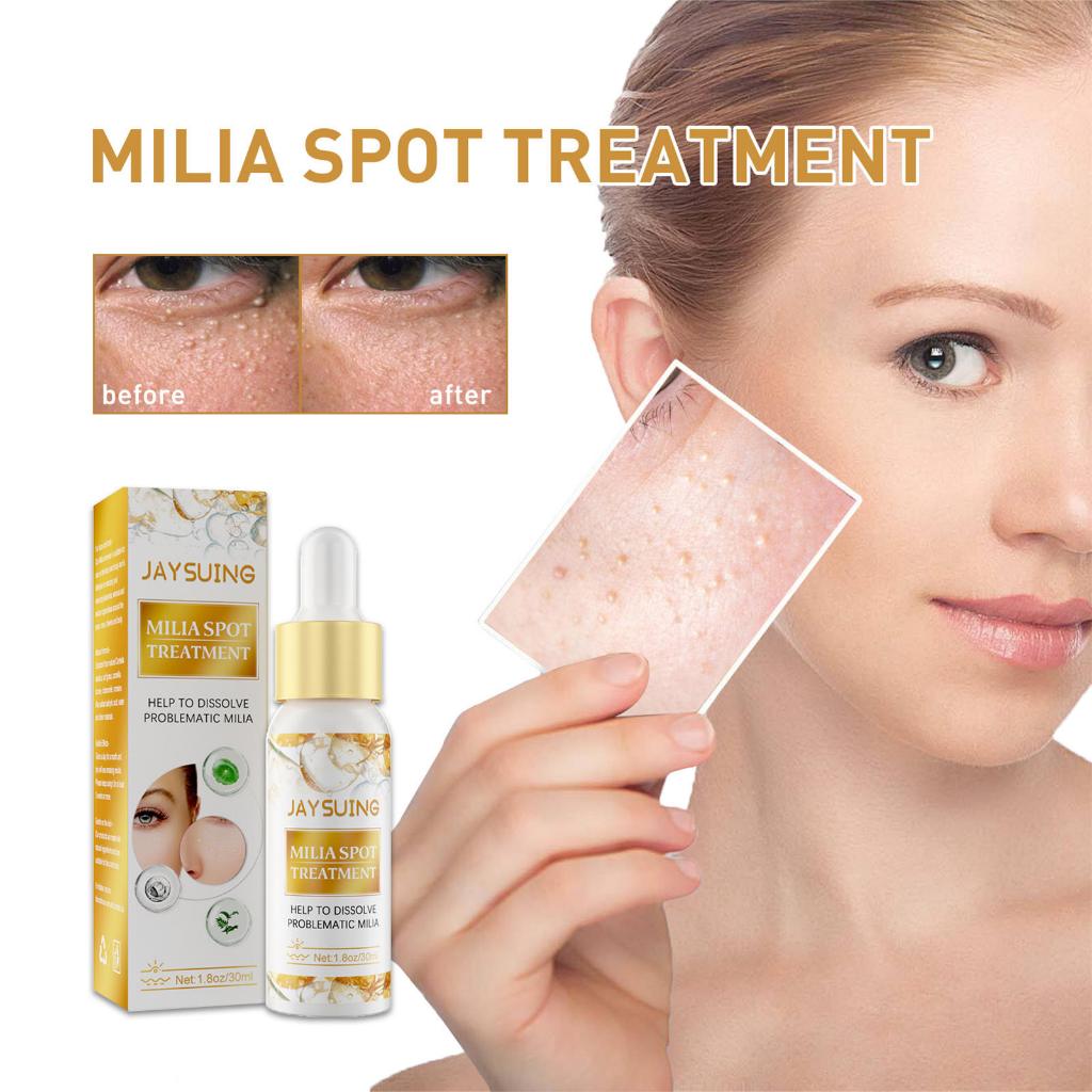 Eye Milia Removal Essential 30ml Eyes Dark Circle Corrector Dark Eye