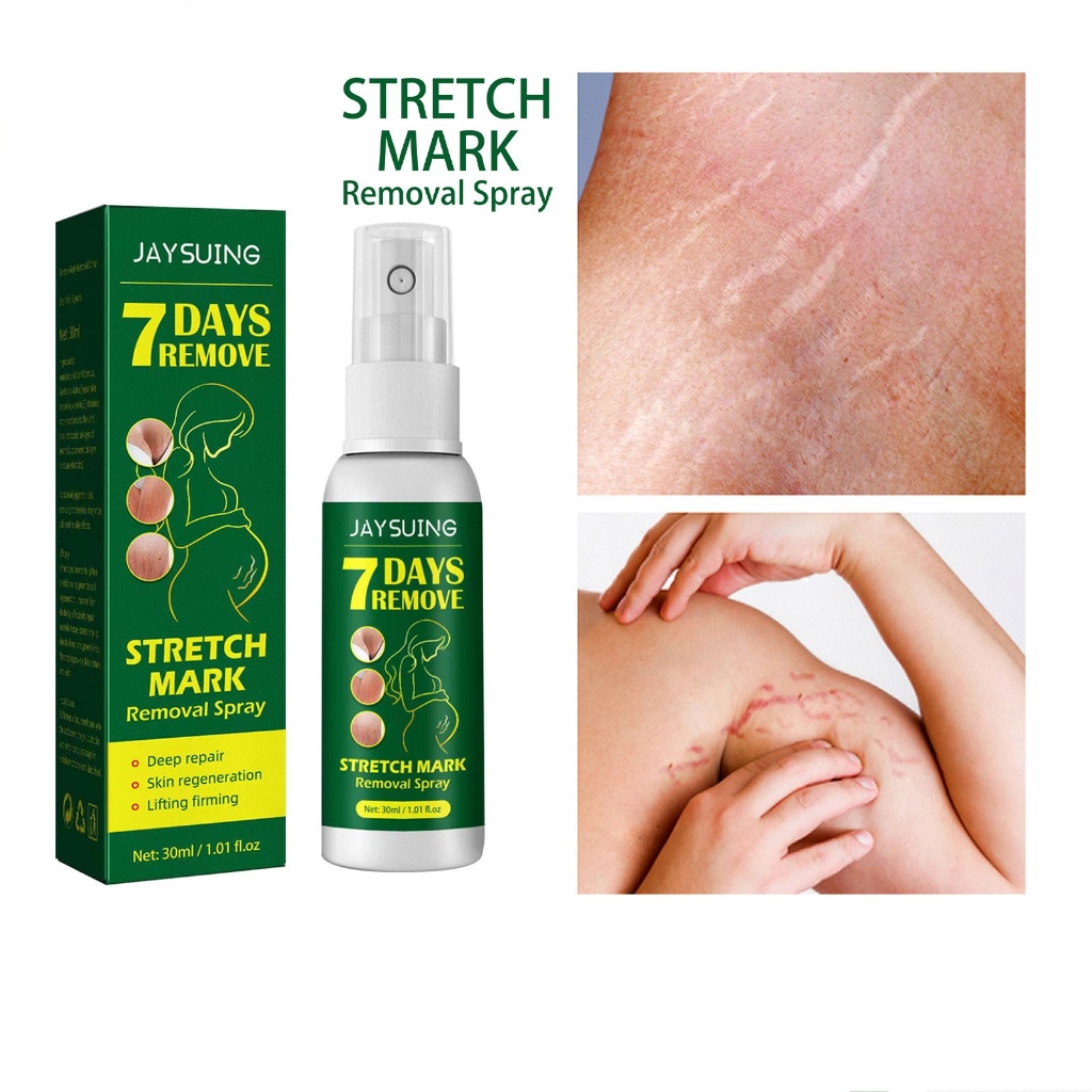 Jaysuing 7 Days Pregnancy Repair Spray Stretch Mark Removal Removal