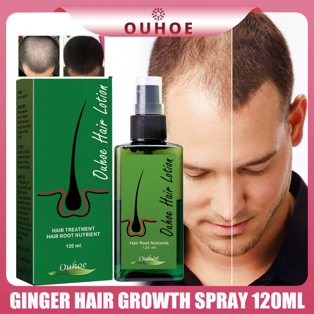 Ouhoe Ginger Hair Growth Spray 100ml Herbal Hair Serum Treat Hair Loss ...