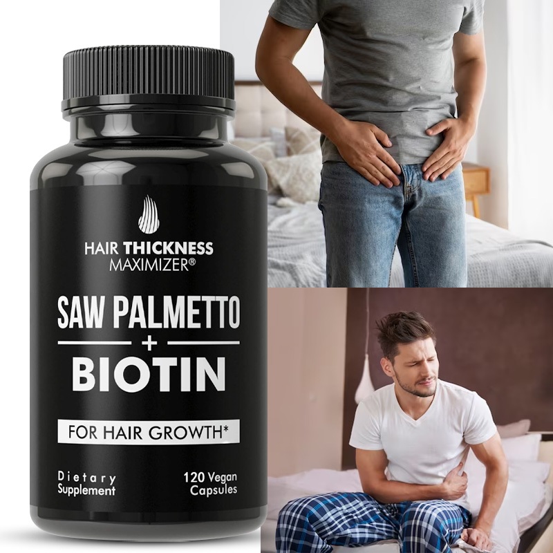 Biotin + Saw Palmetto capsules for hair follicle cell growth. Maximized ...