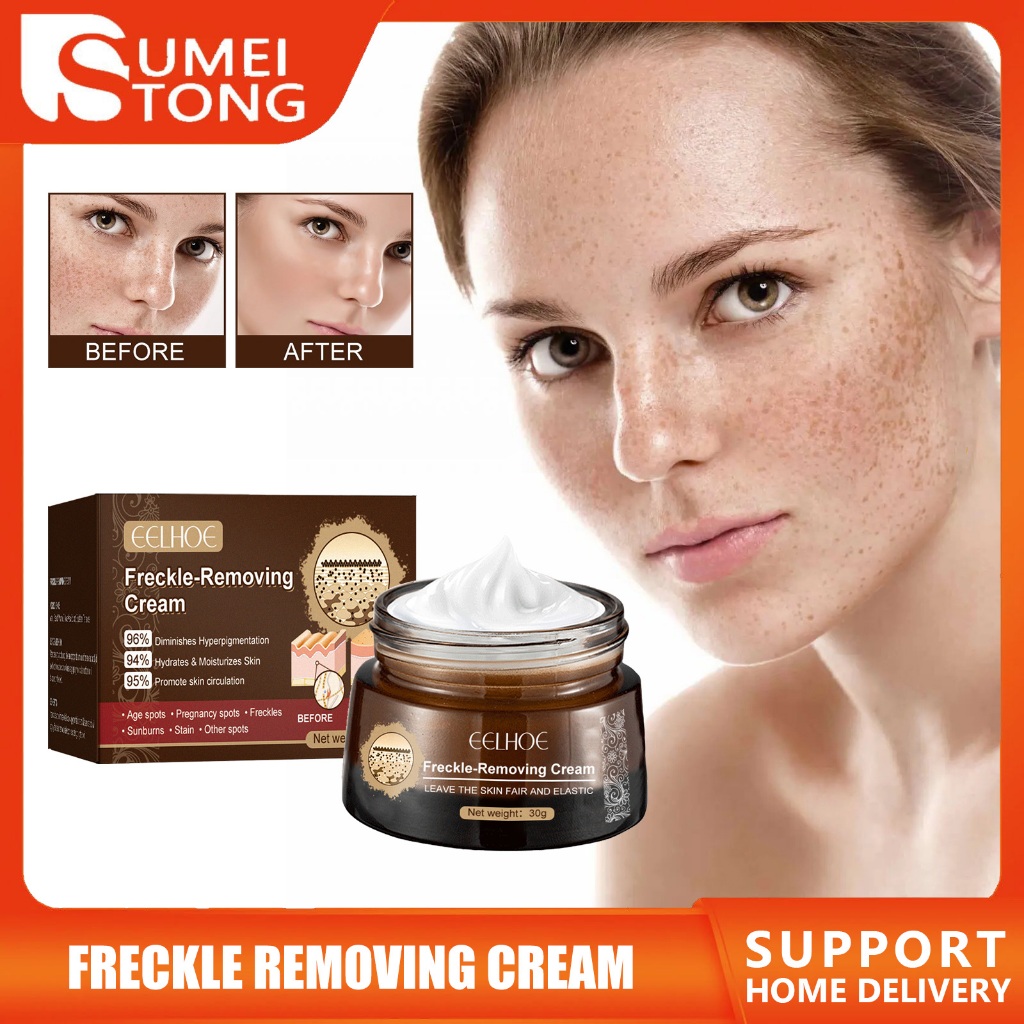 Eelhoe Freckle Removing Cream Retinol Whitening Moisturizer Remove ...