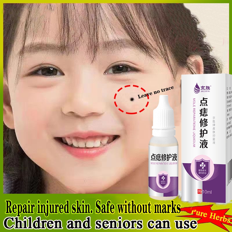 Mole spotting / mole fixing No scars Naevus repair liquid plant removal