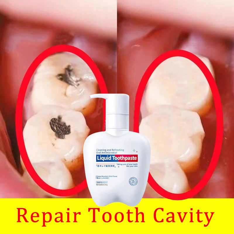 Whitening Toothpaste 200g teeth whitening toothpaste Probiotic ...