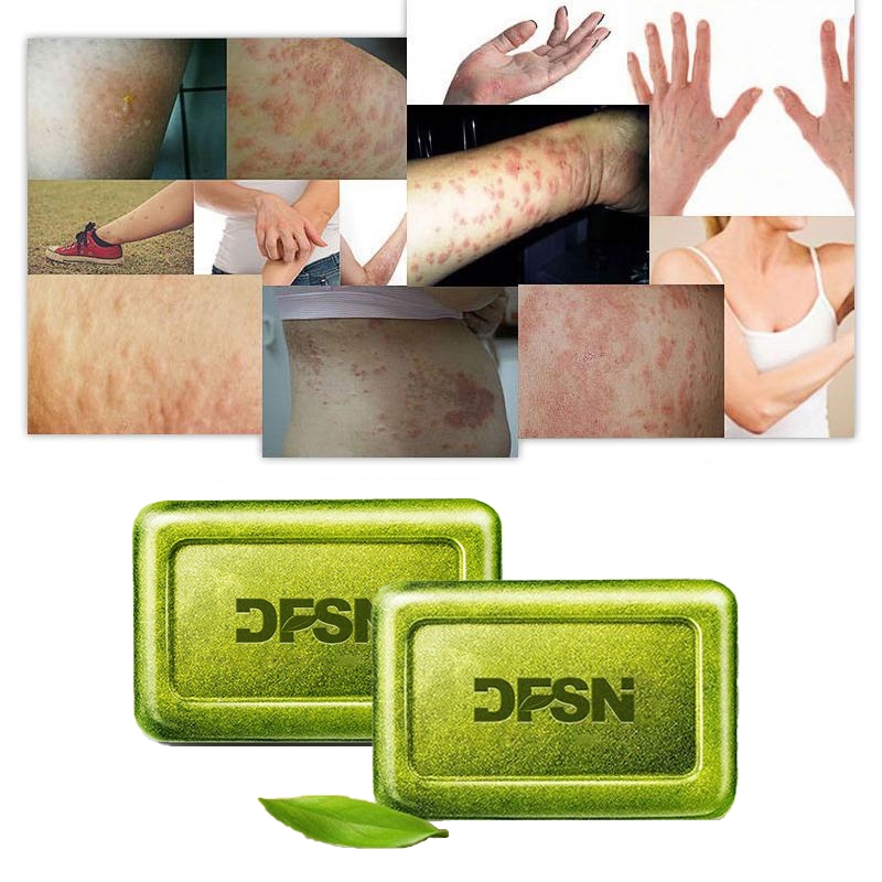 soap sulfur soap sabun gatal kulit 110g 硫磺皂 Mugwort essence prevents bed bugs and mites and