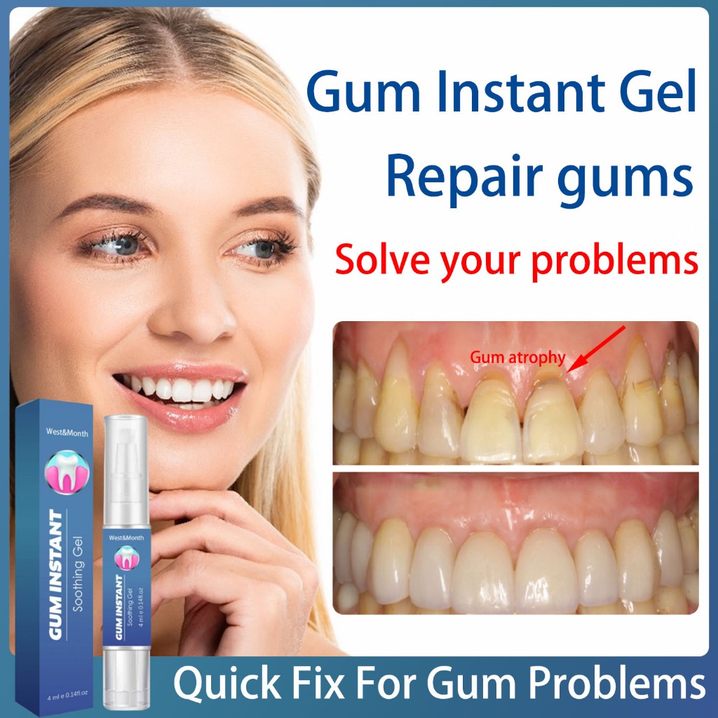 Gum Instant Soothing Gel Receding Gums Therapy Inflammation Treatment