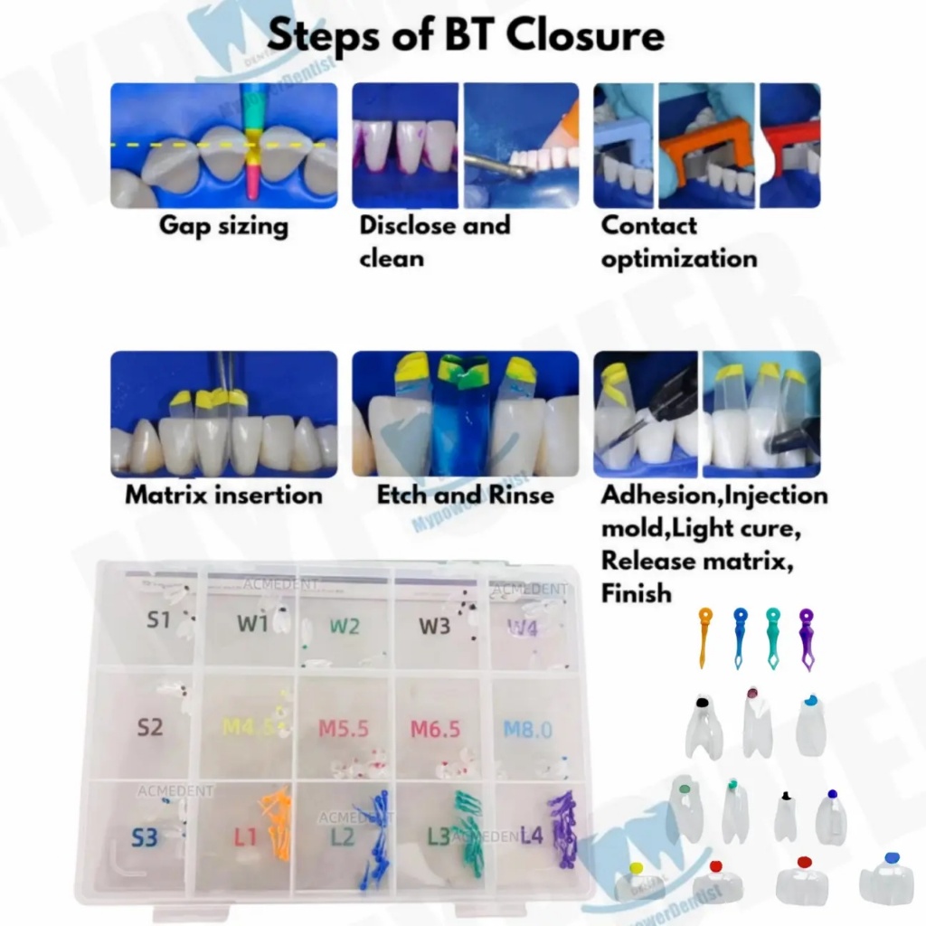 BioClear Style Anterior Kit Modern Matrix System Clear Matrices Molar ...