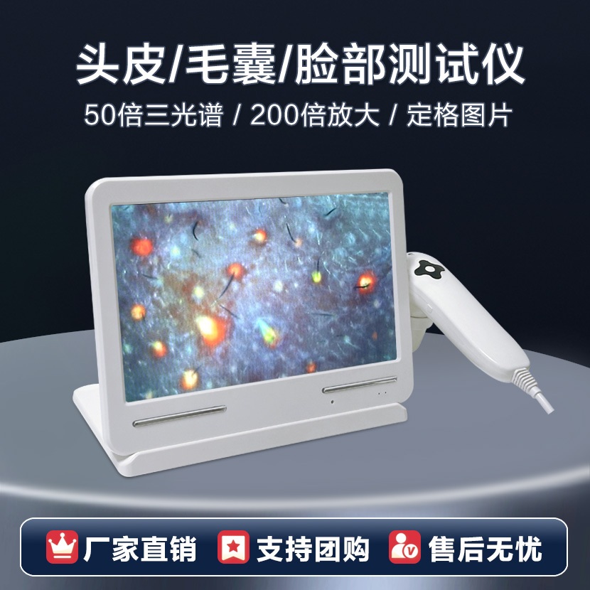 Skin Detector HD Scalp Hair Follicle HD Tester Hair Detection Viewing ...