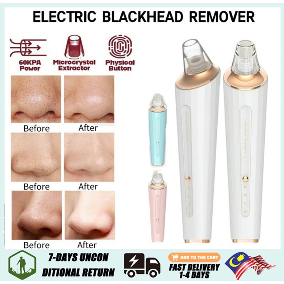 Electric Blackhead Removal With 3 Level Suction 4 Care Heads Pore ...