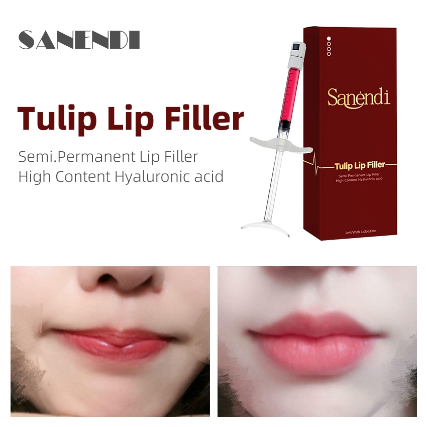 Tulip Lip Filler Essence Hyaluronic Acid Lip Care Hyaluronic Acid Red