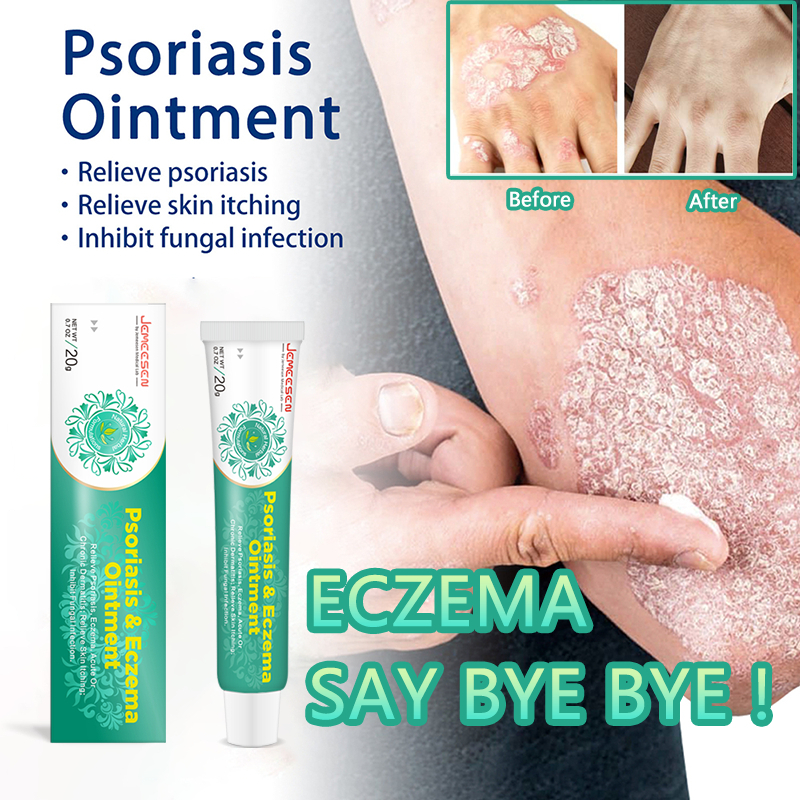 Jemeesen Psoriasis & Eczema Cream Antibacterial Relieve Itching Soothe ...