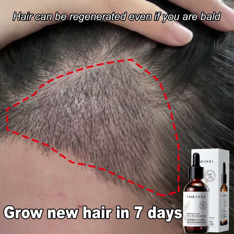 Hair Growth Essence Hair Tonic Fast生发液60ml Dense Hair Growth Oil Hair ...