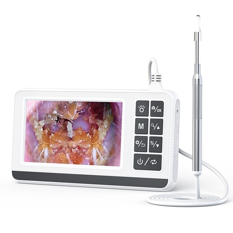 Digital Otoscope 3.9mm 4.3 Inch 1080P HD for Ear Cleaning Smart Visual ...