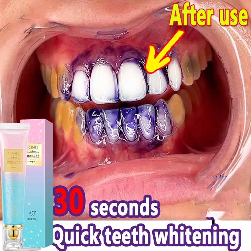 [BUY 2 FREE 1]Toothpaste Whitening toothpaste Niacinamide whitening ...