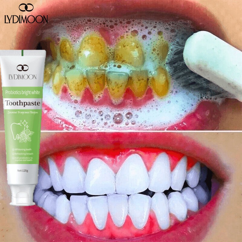 LYDIMOON Teeth Whitening Probiotic Toothpaste 120g Removal Tartar Bad ...