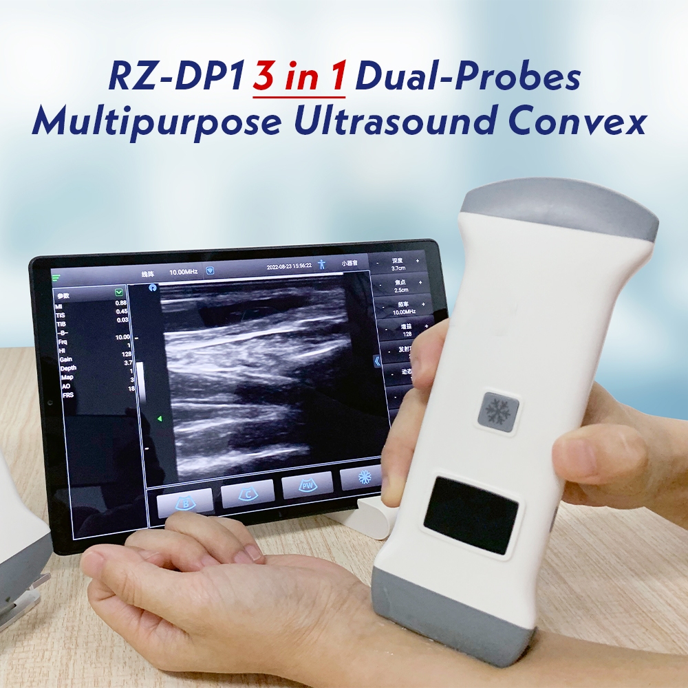 RZ-DP1 Dual-Probes Multipurpose Ultrasound Convex +Linear+ Cardiac ...