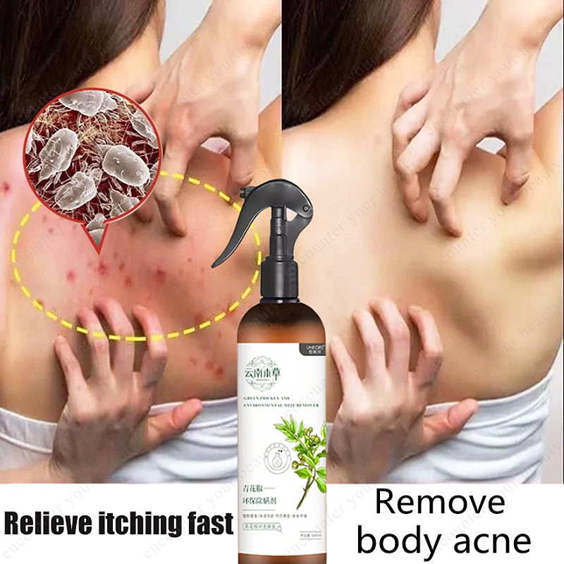 Materia Medica green peppercorns Mite Spray Bed Bug Killer Insect spray ...