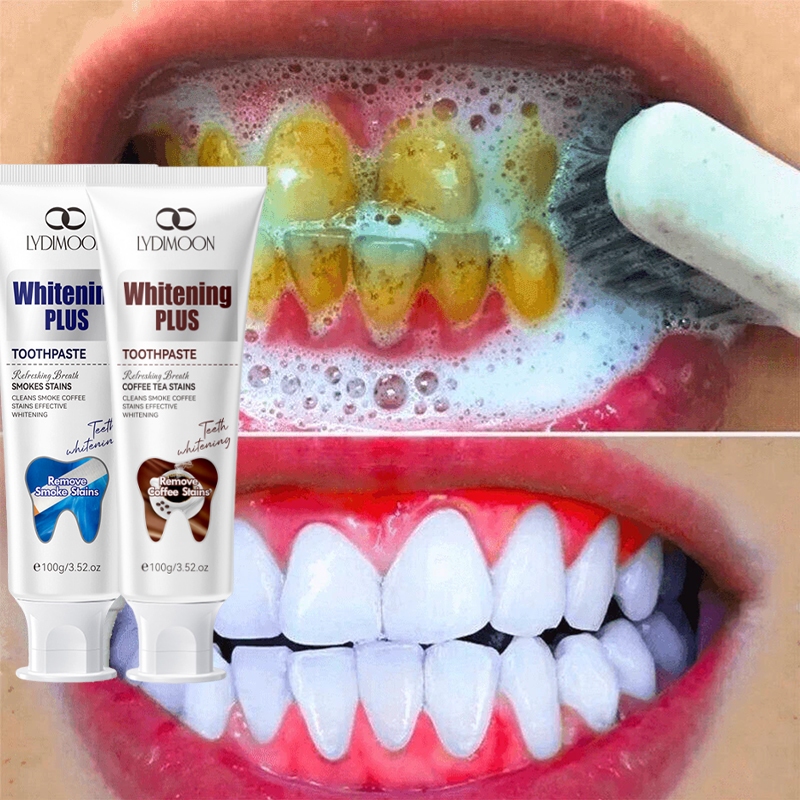 Teeth whitening toothpaste 美白牙膏 100g Remove yellow teeth cigarette ...