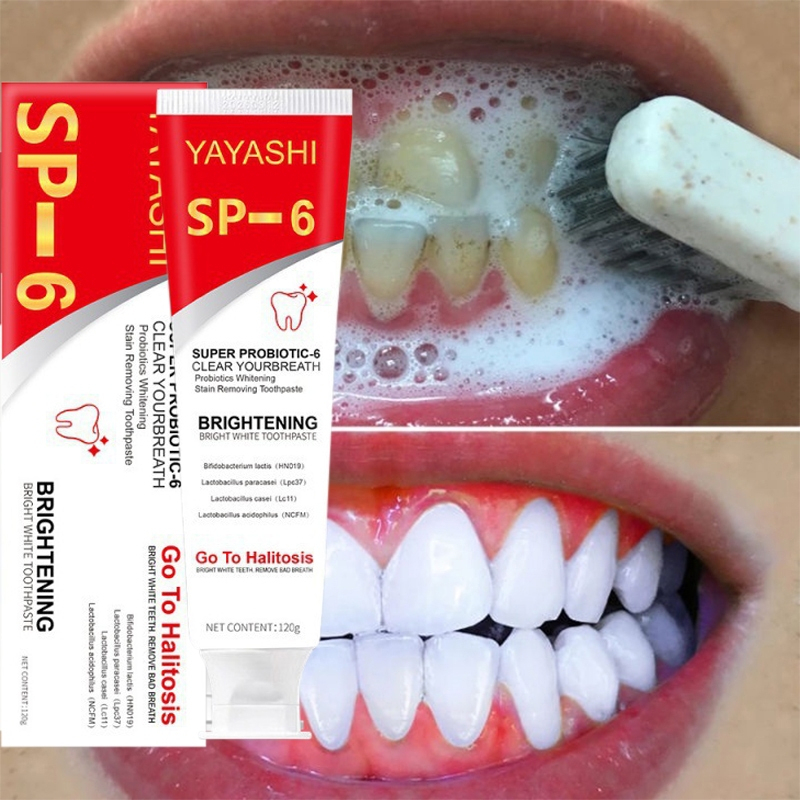SP-6 Teeth Whitening Toothpaste Probiotic Caries Toothpaste for Bad ...