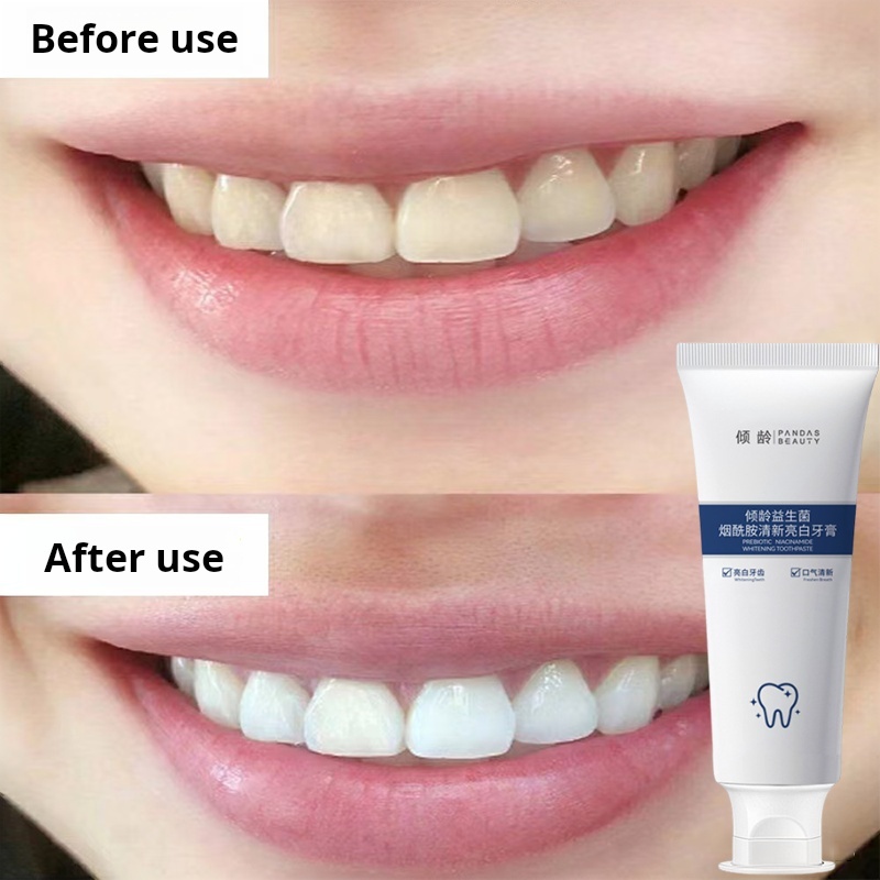 【24-hour shipping】whitening teeth Whitening toothpaste to remove ...