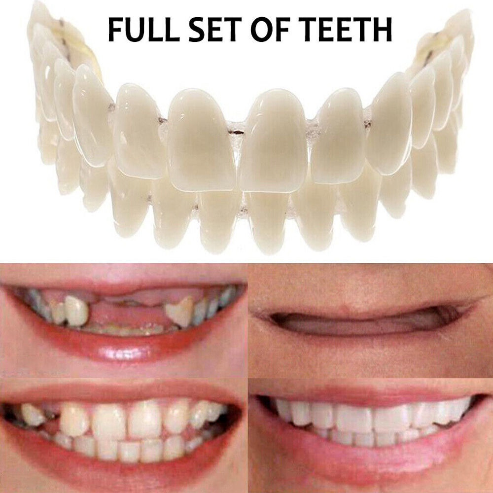 1Set Resin Denture False Teeth Upper + Lower Dental Veneers Tooth Model ...