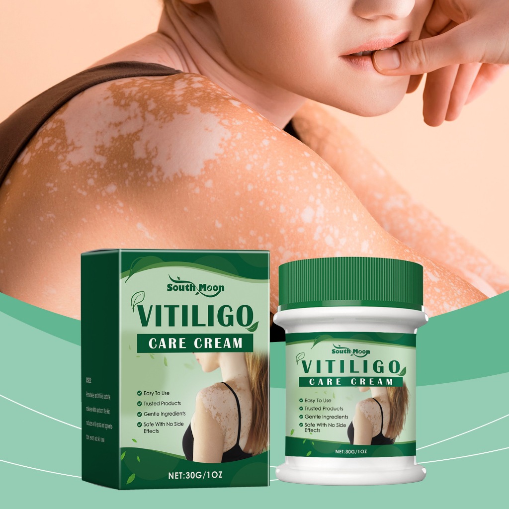 Photo inspiration: Gallery Detail: Vitiligo Leukoplakia Treatment Cream Eliminate Ringworm Cure Mycosis