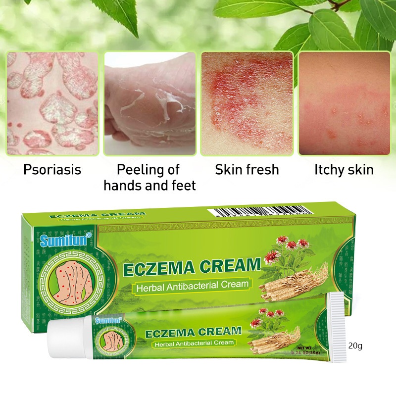 Sumifun Dermatitis Care Cream 20g Wet Toxic Eczema | Shopee Malaysia