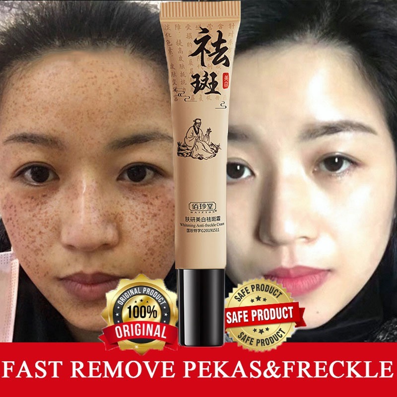 Houmai Melasma Removal Skin Whitening And Anti-Freckle Removing Cream Remove Pekas Melasma Get Rid Of Dark Spot 20g I4120877183