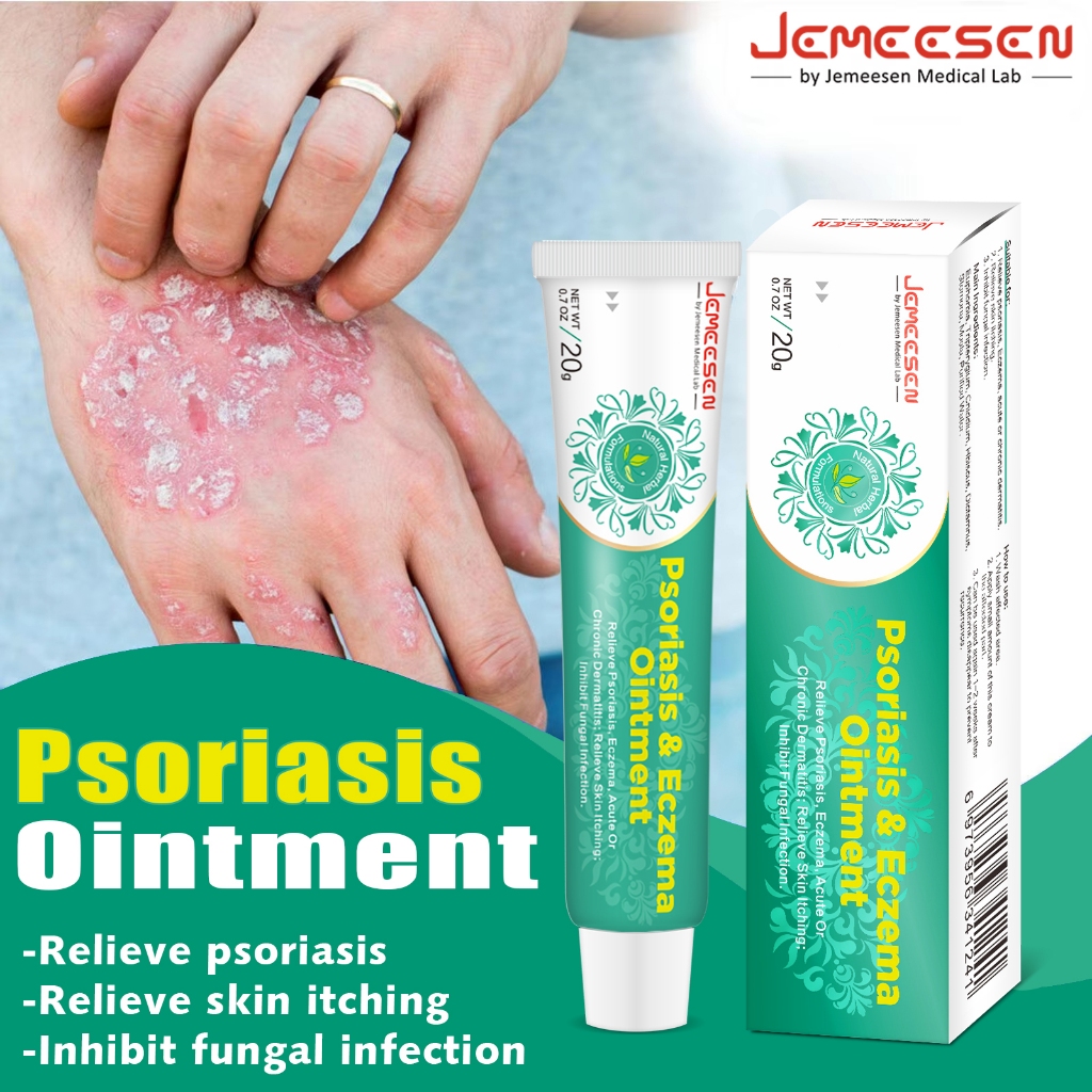 Jemeesen Psoriasis & Eczema Ointment Relieve itching Anti microbial ...