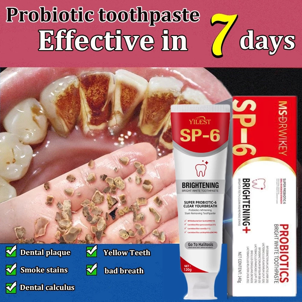 Whitening toothpaste probiotic toothpaste, improve yellow teeth, remove ...