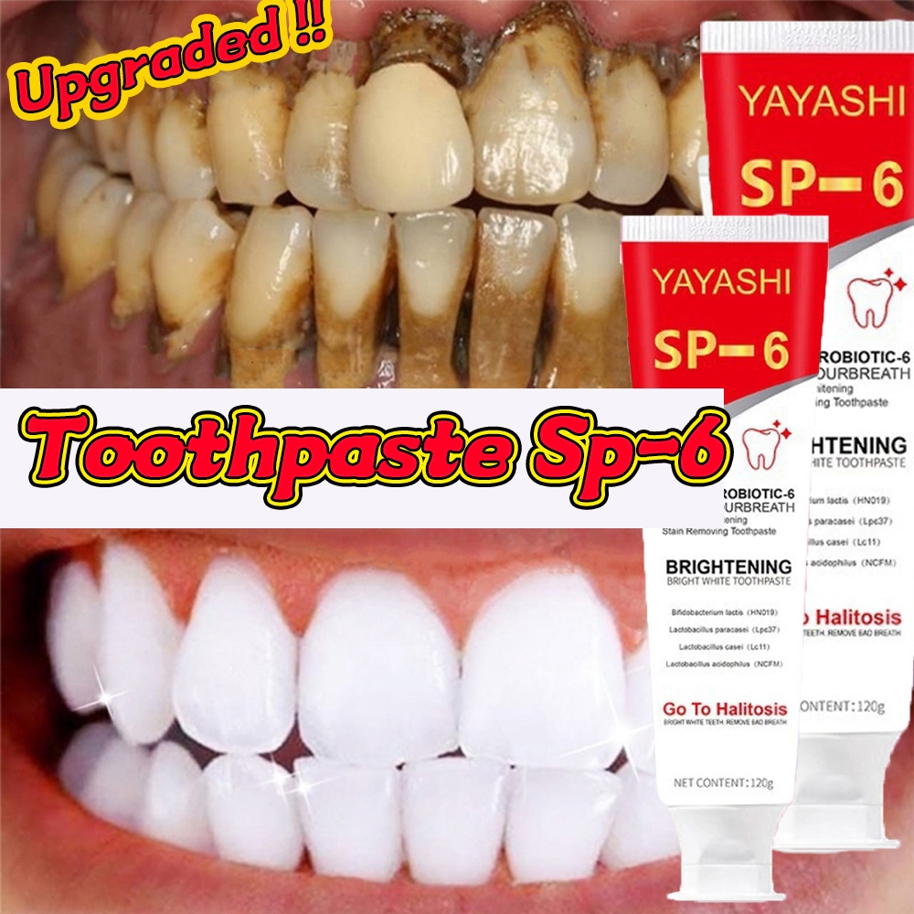 120g SP-6 Whitening Toothpaste Probiotic Caries Toothpaste for Bad ...