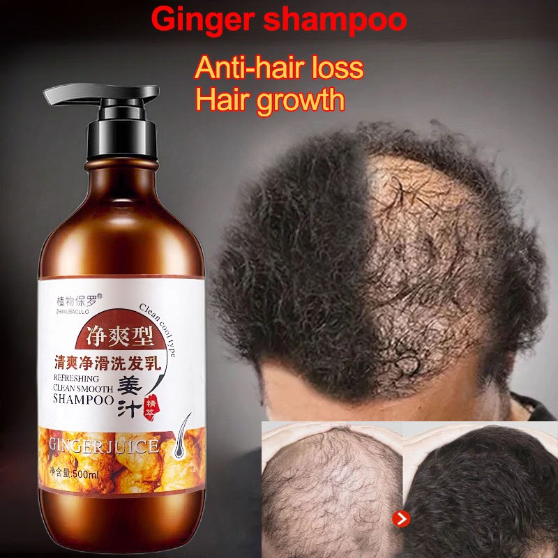 Anti-hair loss shampoo-rambut gugur-hair fall shampoo Rambut Pelebat ...