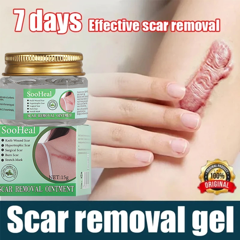 Scar Removal Cream Effective removes black scars/acne scar removal ...