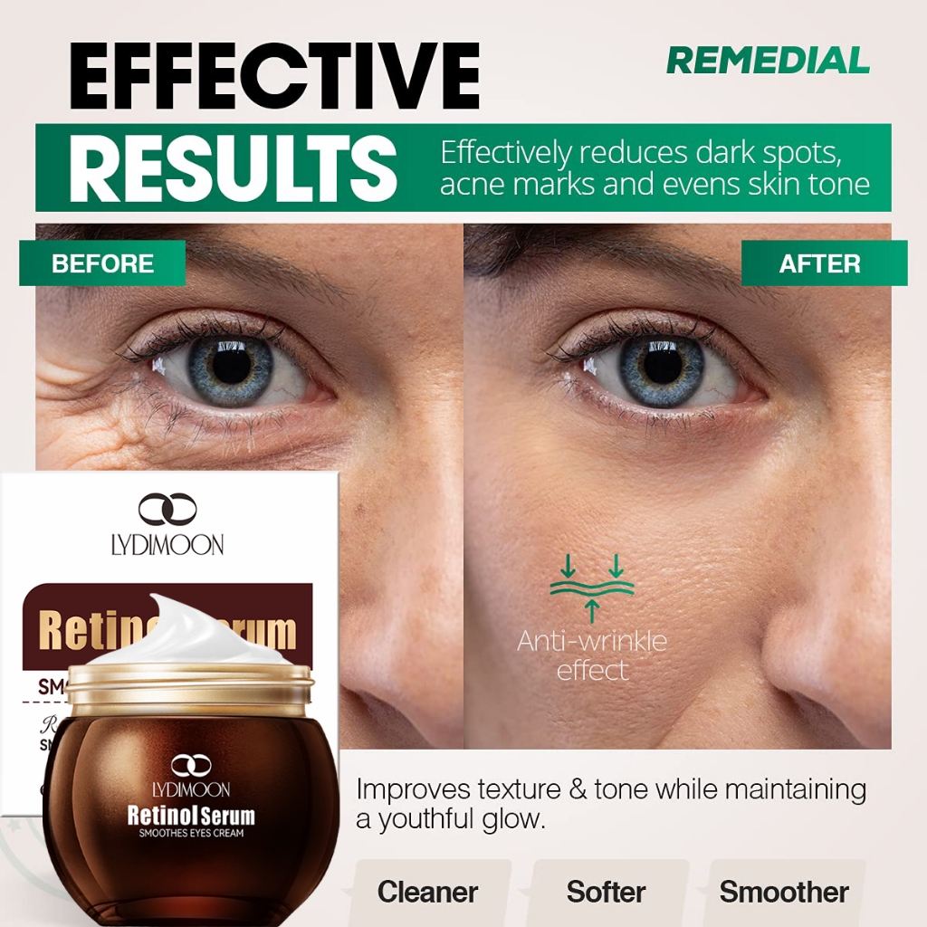 LYDIMOON Pro Vacuum Microcapsule Retinol |Banish Dark Circles+Puffiness ...