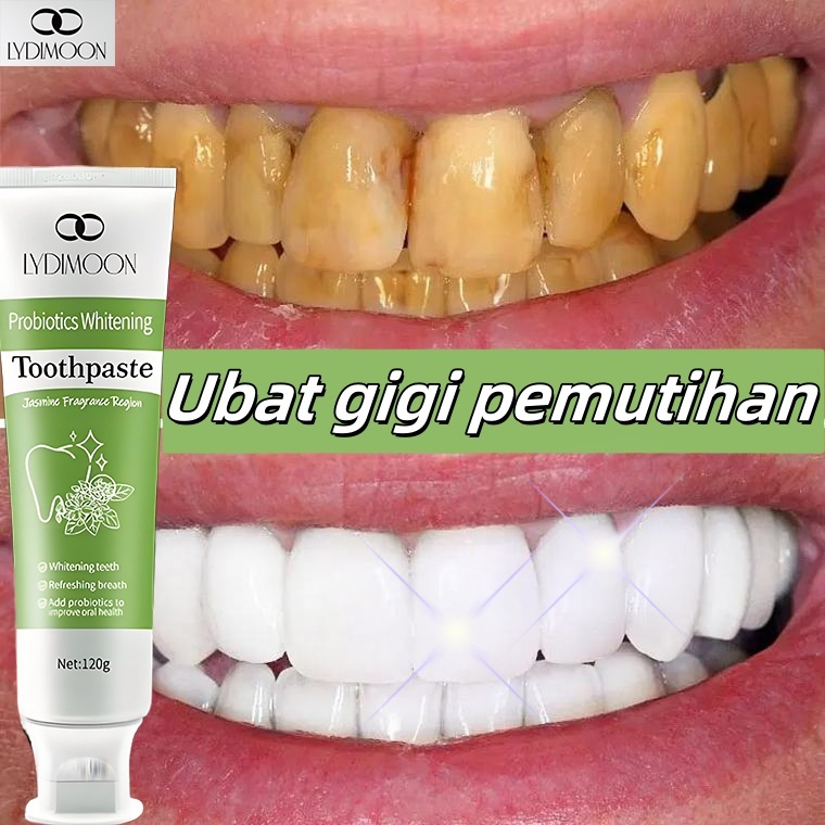 Probiotic whitening toothpaste Whitening tooth toothpaste to remove ...