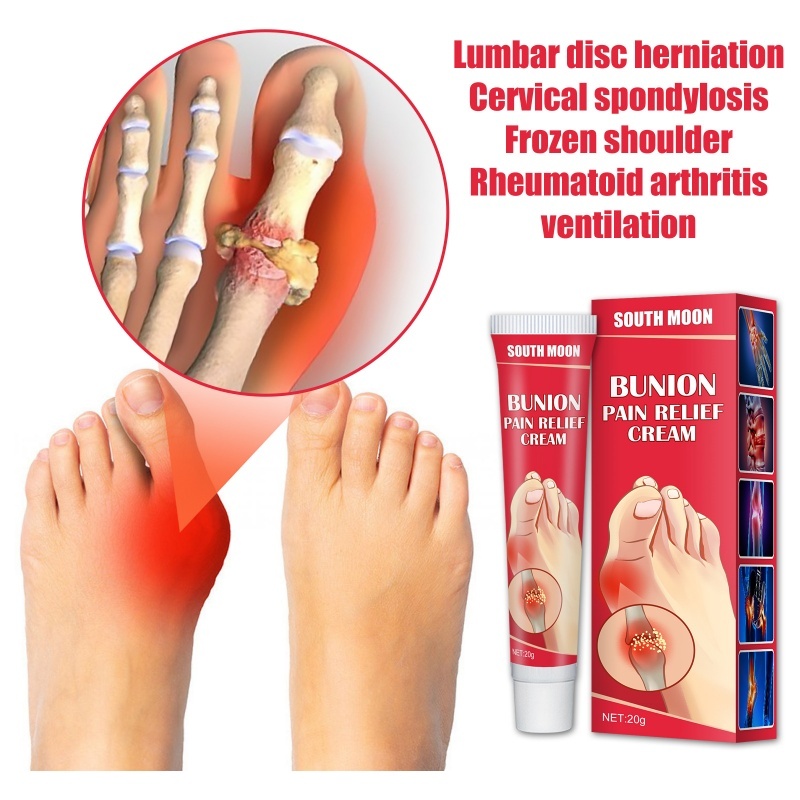 South Moon Bunion Pain Relief Cream Joint Toe Pain Relief Stiffness ...