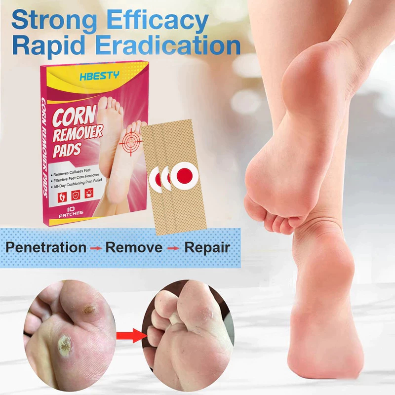 【Fast Effective 】Foot Corn Remover Ketuat Remover Corn Patch Ubat ...