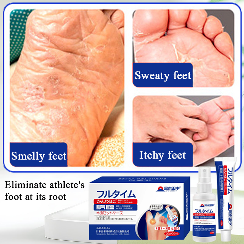 Foot spray foot deodorant 20g+30ml Athlete's foot peeling blisters ...