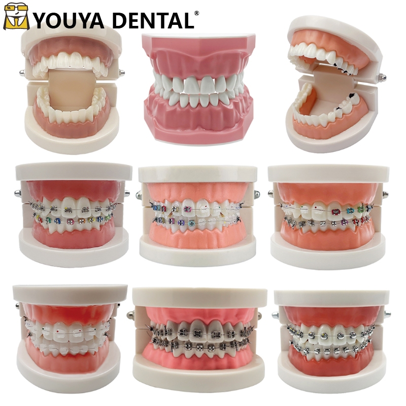 1PCS Dental Teeth Model Standard Dental Orthodontic Model For Dental ...