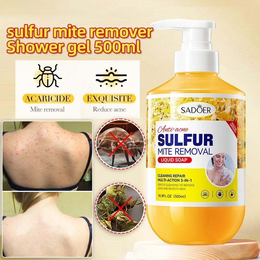 Sadoer Sulfur Soap anti mite shower gel Acne Body Wash Relieve Itching ...